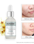 5% Niacinamide + Hyaluronic Acid Serum - 30ml
