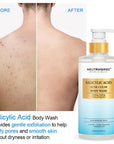 Salicylic Acid Body Wash For Acne Prone Skin -500ml