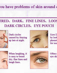 Eye Gel For Wrinkles & Eyebags
