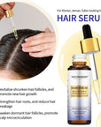 Intense Hair Growth Serum For Hair Density - 30ml