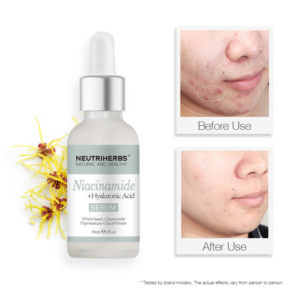 5% Niacinamide + Hyaluronic Acid Serum - 30ml