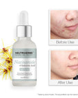 5% Niacinamide + Hyaluronic Acid Serum - 30ml