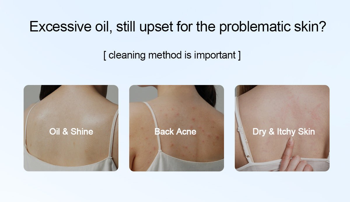 Salicylic Acid Body Wash For Acne Prone Skin -500ml