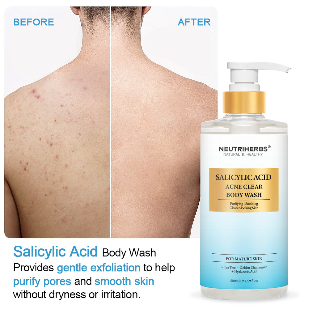 Salicylic Acid Body Wash For Acne Prone Skin -500ml