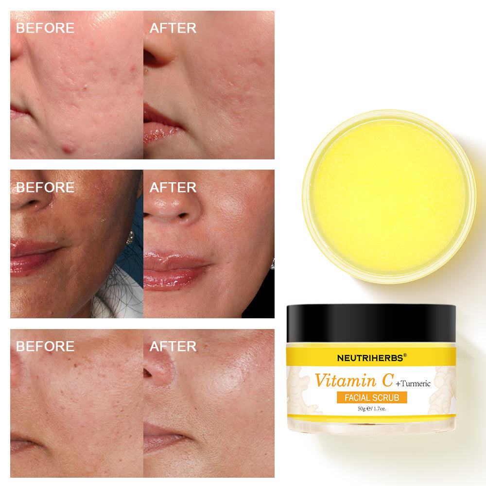Vitamin C Turmeric Exfoliating Glow Facial Scrub - 50g